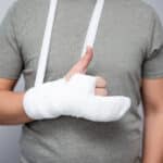 gebrochene hand schmerzensgeld​